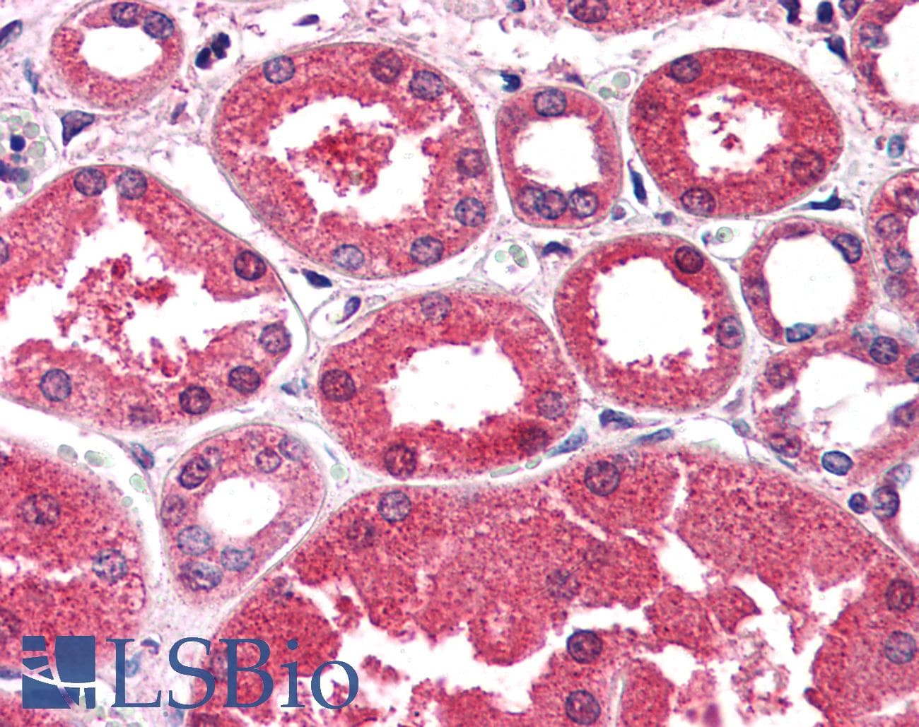 IHC-plus™ Polyclonal Goat anti-Human AKR1A1 Antibody (aa313-325, IHC, WB)