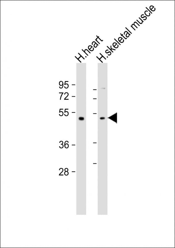 TRIM55 / MURF2 Antibody (aa216-250)
