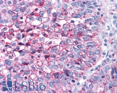 PathPlus™ Polyclonal Rabbit anti-Human RORC / ROR Gamma Antibody (Ligand-binding Domain, IHC)