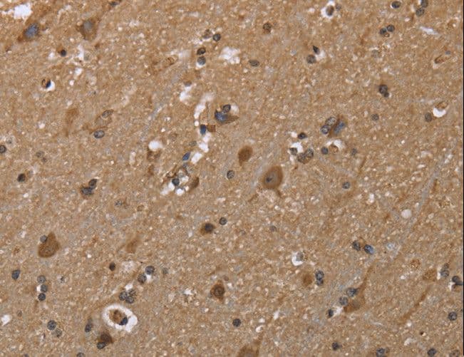 Polyclonal Rabbit anti-Human GALK1 / GK1 Antibody (IHC, WB)