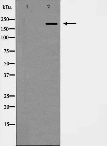 ITGB4 / Integrin Beta 4 Antibody
