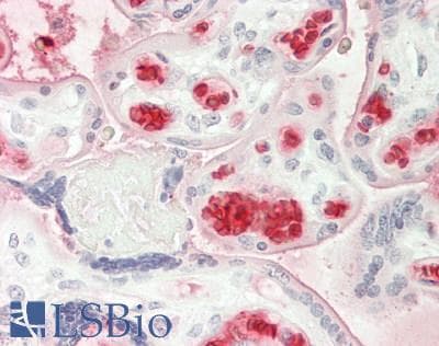 IHC-plus™ HBG1 / Fetal Hemoglobin Antibody