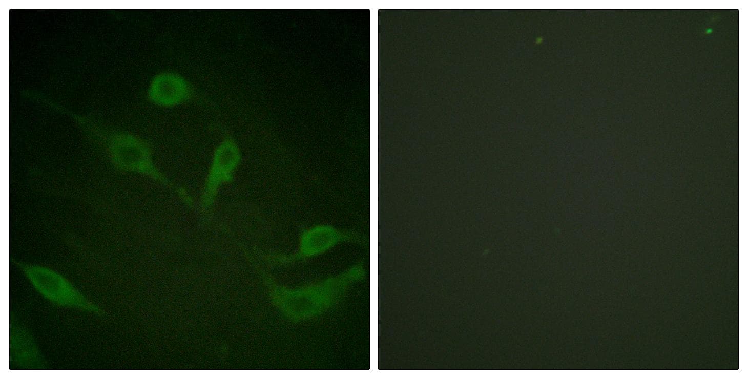 KRT18 / CK18 / Cytokeratin 18 Antibody (phospho-Ser33)