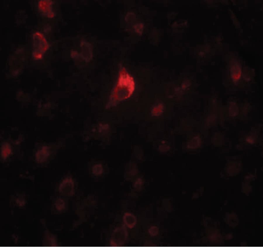 IHC-plus™ PICALM / CALM Antibody
