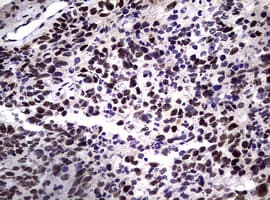 NBN / Nibrin Antibody (clone OTI6H7)