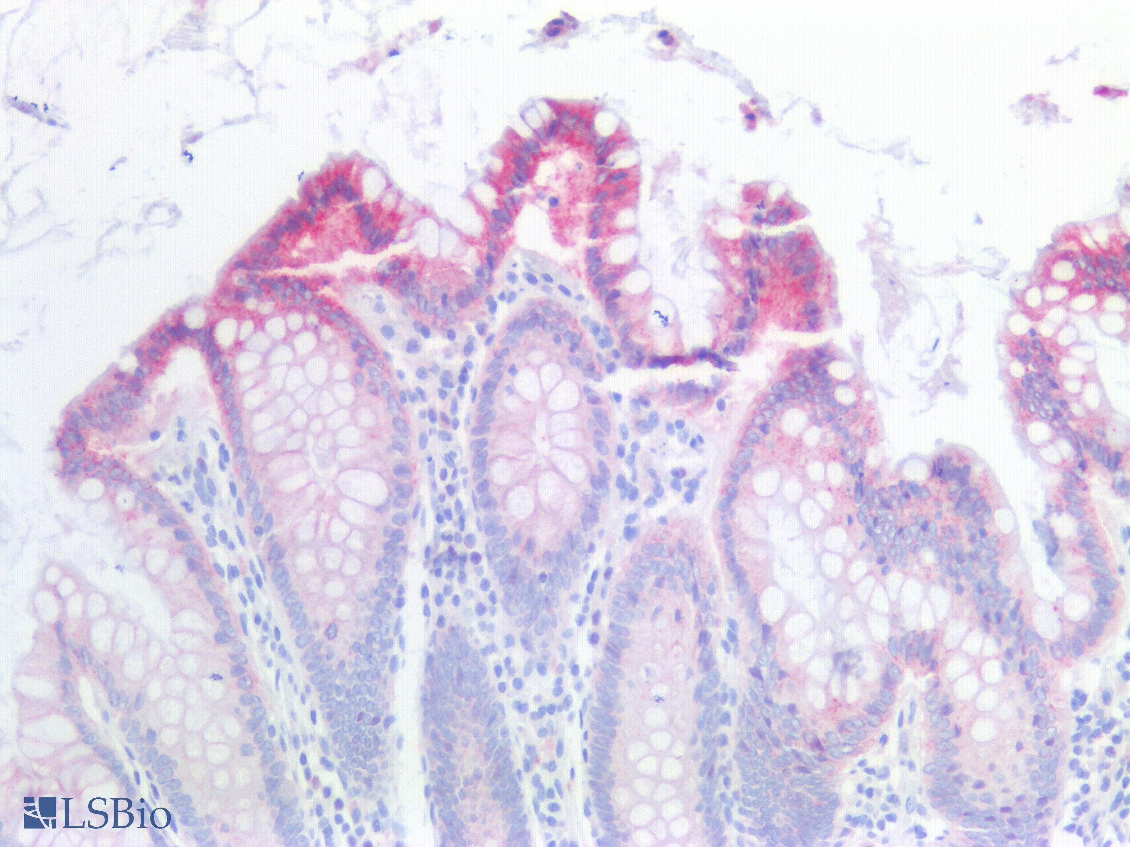 IHC-plus™ Polyclonal Rabbit anti-Human CTNNB1 / Beta Catenin Antibody (N-Terminus, IHC, WB)