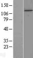 TTI1 Protein (Over-Expression Lysate Myc-DDK (Flag))