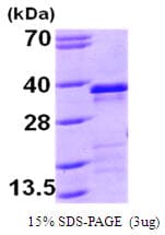 Human EBAG9 / RCAS1 Protein (Recombinant His)