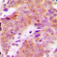 RPS6KB1 / P70S6K / S6K Antibody (phospho-Thr421)