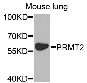 PRMT2 Antibody
