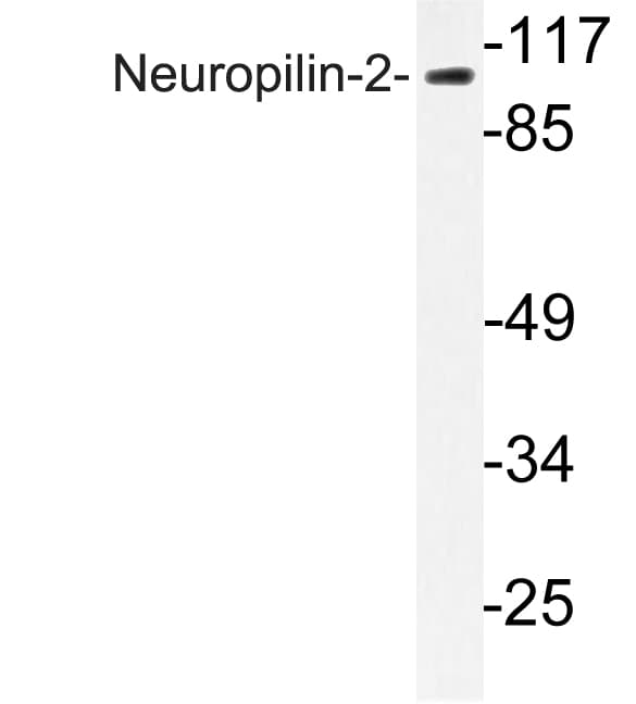 NRP2 / Neuropilin 2 Antibody (aa324-373)
