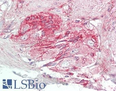 IHC-plus™ Polyclonal Rabbit anti-Human MAPK8IP1 / JIP1 Antibody (aa69-118, IHC, IF, WB)