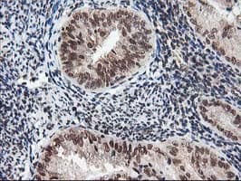 NUDT18 Antibody (clone OTI5D7)