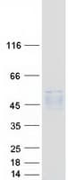 Human PSG / PSG5 Protein (Recombinant Myc-DDK (Flag))