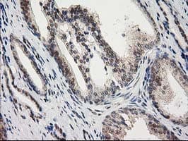 PRKCE / PKC-Epsilon Antibody (clone OTI2A12)