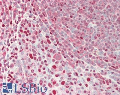 IHC-plus™ Polyclonal Rabbit anti-Human TPI1 / TPI Antibody (IHC, IF, WB)