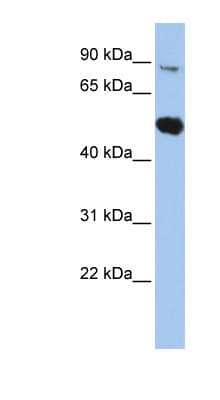 Polyclonal Rabbit anti-Human SOX6 Antibody (C-Terminus, IHC, WB)