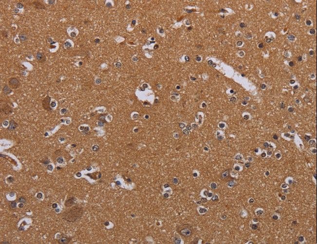 MAGEB10 Antibody