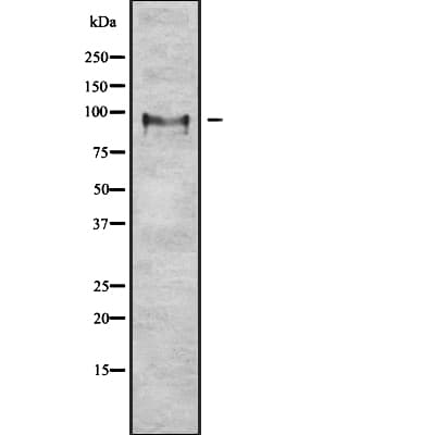 FGA / Fibrinogen Alpha Antibody