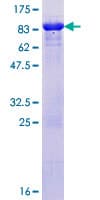 Human RAD23A / HHR23A Protein (Recombinant GST)