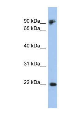 PathPlus™ Polyclonal Rabbit anti-Human CDH1 / E Cadherin Antibody (aa503-552, IHC, WB)