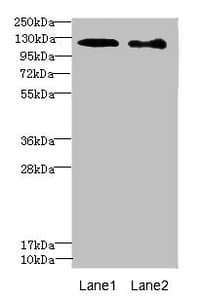 Polyclonal Rabbit anti-Human DIAPH2 Antibody (IHC, WB)
