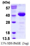 Human PDCL Protein (Recombinant His)