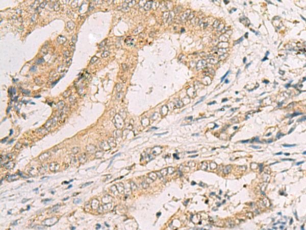 SPACA1 Antibody