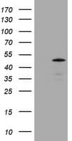 ABCB1 / MDR1 / P Glycoprotein Antibody (clone OTI2G4)