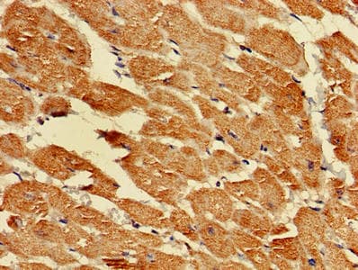 LDHD / Lactate Dehydrogenase D Antibody