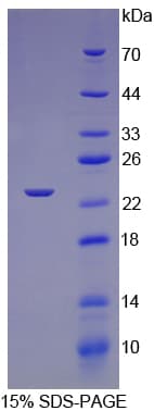 Rat TNNI1 Protein (Recombinant His)
