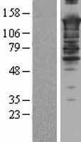 SMARCC2 Protein (Over-Expression Lysate Myc-DDK (Flag))