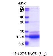 Human SVIP Protein (Recombinant His)