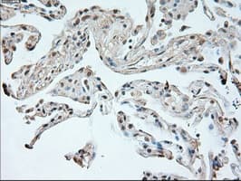 NEUROG1 / NGN1 / Neurogenin 1 Antibody (clone OTI9A8)