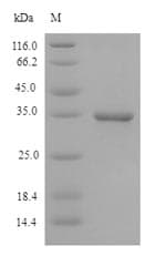 Guinea pig CD46 Protein (Recombinant 6His, N-terminus)