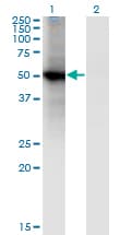 Monoclonal Mouse anti-Human RORB / ROR Beta Antibody (clone 4B4, WB)