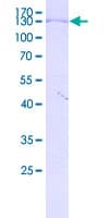 Human GTSE1 Protein (Recombinant GST)