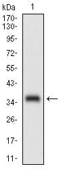 PathPlus™ MCAM / CD146 Antibody (aa84-189, clone 6C3E6)