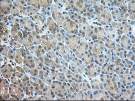 ERIC-1 / TACC3 Antibody (clone OTI1E4)