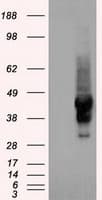 SERPINA1 / Alpha 1 Antitrypsin Antibody (clone OTI3C5)