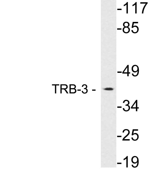Polyclonal Rabbit anti-Human TRB3 / TRIB3 Antibody (aa305-354, WB)