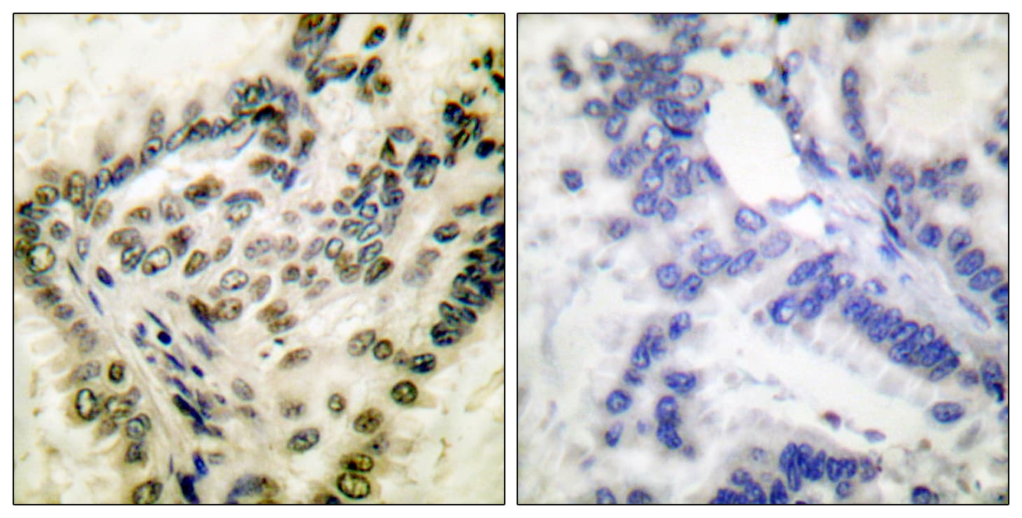 Polyclonal Rabbit anti-Human CREB1 / CREB Antibody (phospho-Ser142, IHC, IF, WB)