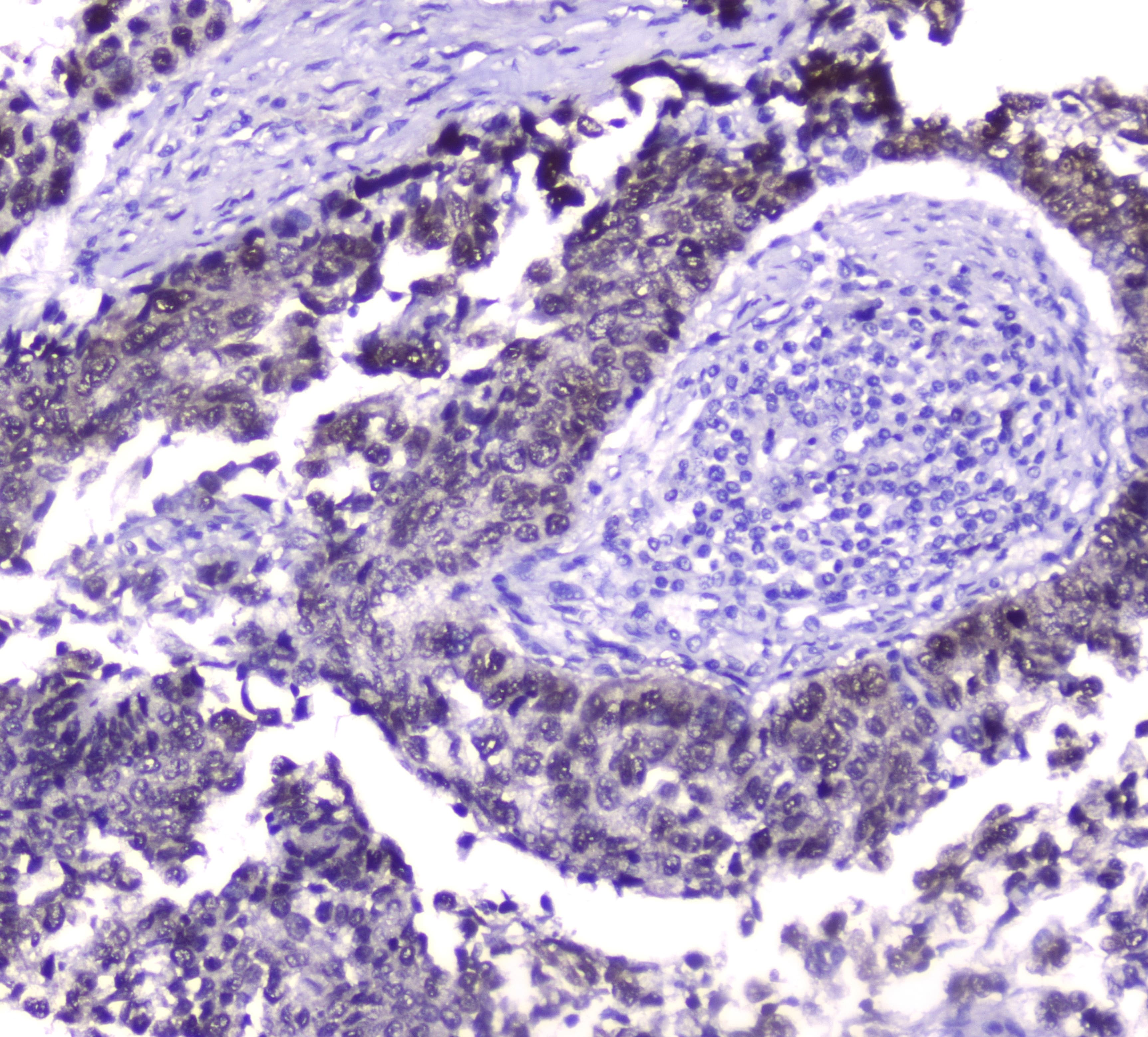 HSPA1A Antibody