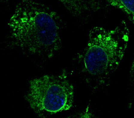 PathPlus™ CANX / Calnexin Antibody (C-Terminus)