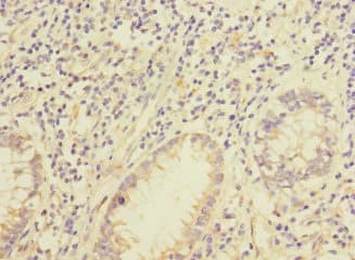 Polyclonal Rabbit anti-Human IQCC Antibody