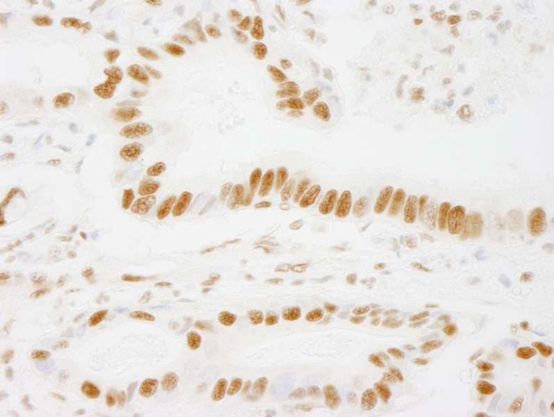 Polyclonal Rabbit anti-Human ACIN1 / Acinus Antibody (aa1291-C-term, IHC)