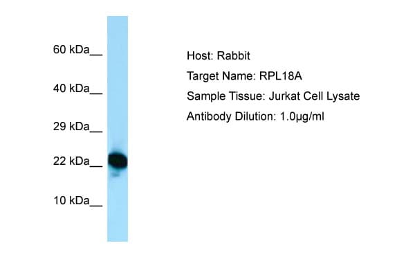 RPL18A Antibody (C-Terminus)