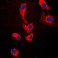 MYD88 Antibody (Internal)