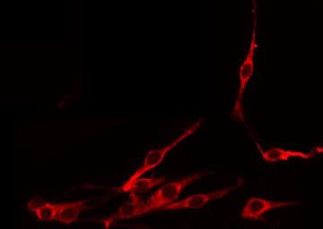 Polyclonal Rabbit anti-Human SOST / Sclerostin Antibody (IF, WB)