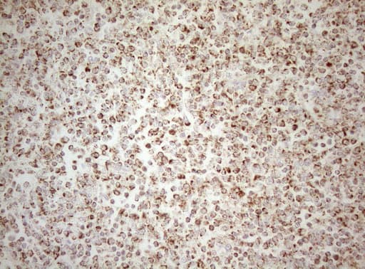 DECR1 Antibody (clone OTI4G4, Carrier-free)